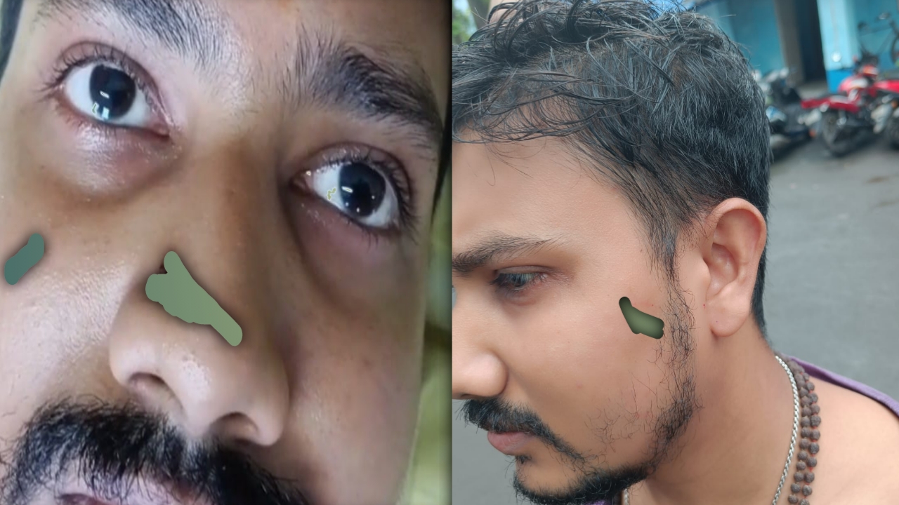 তৃণমূলী দুষ্কৃতীদের হাতে আক্রান্ত সাংবাদিক ও মা